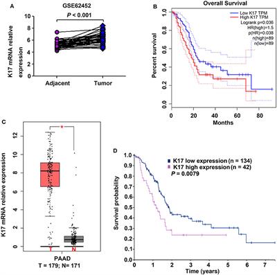 Keratin 17 Suppresses Cell Proliferation and Epithelial-Mesenchymal Transition in Pancreatic Cancer